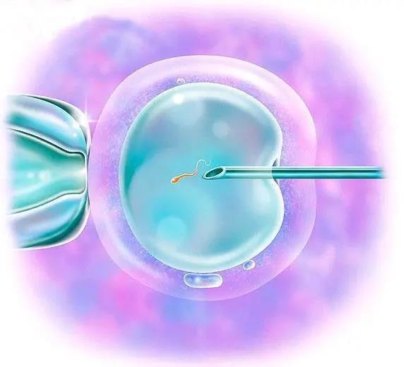 扬州供卵试管婴儿技术帮助各种人怀孕